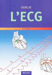 Guide de l'ECG - H-H.EBERT