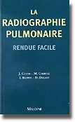 La radiographie pulmonaire rendue facile - J.CORNE, M.CARROLL, I.BROWN, D.DELANY