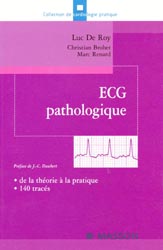 ECG pathologique - Luc DE ROY, Christian BROHET, Marc RENARD - ELSEVIER / MASSON - Cardiologie pratique