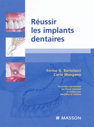 Réussir les implants dentaires - Enrico G.BARTOLUCCI, Carlo MANGANO