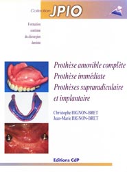 Prothèse amovible complète Prothèse immédiate Prothèses supraradiculaire et implantaire - Christophe et Jean-Marie RIGNON-BRET