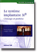 Le système implantaire 3i Chirurgie et prothèse - Thierry DEGORCE, Frédéric CHICHE