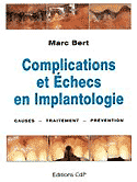 Complications et échecs en implantologie - M.BERT