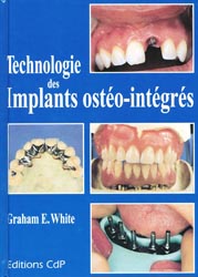 Technologie des implants ostéo-intégrés - GE.WHITE