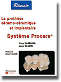 La prothèse céramo-céramique et implantaire : système Procera - Y.SAMAMA, J.OLLIER