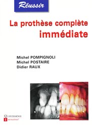 La prothèse complète immédiate - M.POMPIGNOLI, M.POSTAIRE, D.RAUX