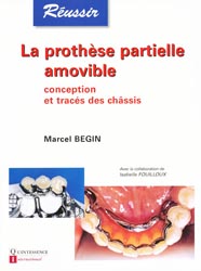 La prothèse partielle amovible - Marcel BEGIN, Isabelle FOUILLOUX