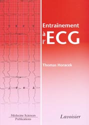 Entraînement à l'ECG - Thomas HORACEK