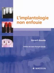 L'implantologie non enfouie - Gérard AOUATE