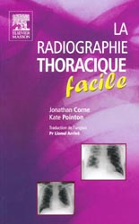 La radiographie thoracique facile - Jonathan CORNE, Kate POINTON - ELSEVIER / MASSON - 