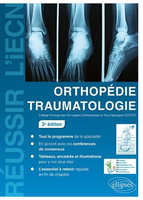Orthopédie Traumatologie - 2e édition - Collège Français des Chirurgiens Orthopédistes et Traumatologues