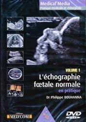L'échographie foetale normale en pratique  Vol 1 - Dr Philippe BOUHANNA - MED'COM - Medical'Media  Pratique médicale et chirurgicale