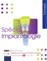 Spécial Implantologie - Marzan DAAS, Karim DADA - ESPACE ID - Concepts 12