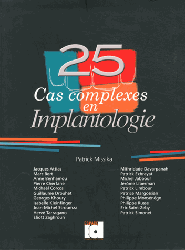 25 Cas complexes en Implantologie - Patrick MISSIKA, Collectif