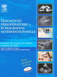 Diagnostic périopératoire et échographie interventionnelle - HARMON