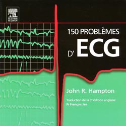 150 problèmes d'ECG - Jhon R. HAMPTON