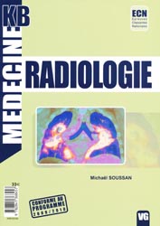 Radiologie - Michaël SOUSSAN - VERNAZOBRES - Médecine KB