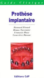 Prothèse implantaire - B.PICARD, B.TAVERNIER, F.HARY, G.BUSSAC