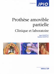 Prothèse amovible partielle Clinique et laboratoire - Jean SCHITTLY, Estelle SCHITTLY