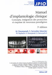 Manuel d'implantologie clinique - M.DAVARPANAH, S.SZMUKLER-MONCLER, Ph. RAJZBAUM, K.DAVARPANAH, G. DEMURASHVILI, Collectif