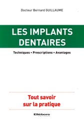 Les implants dentaires - Guillaume BERNARD - ELLEBORE - 