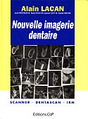 Nouvelle imagerie dentaire : scanner-dentascan-IRM - A.LACAN