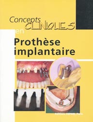 Concepts cliniques en prothèse implantaire - François UNGER - SNPMD - Concepts cliniques