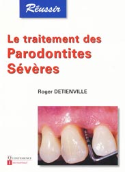 Le traitement des parodontites sévères - R.DETIENVILLE