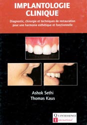 Implantologie clinique - Ashok SETHI, Thomas KAUS