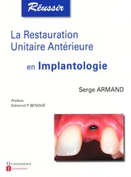 La restauration Unitaire Antérieure en Implantologie - Serge ARMAND