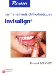 Les traitements orthodontiques invisalign - Richard BOUCHEZ