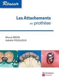 Les attachements en prothèse - Marcel BEGIN, Isabelle FOUILLOUX
