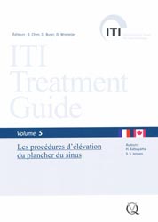 ITI Treatment Guide Vol 5 - H.KATSUYAMA, S.S.JENSEN - QUINTESSENCE INTERNATIONAL - 