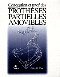Conception et trac des prothses partielles amovibles - Normand BRIEN - PROSTHO - 